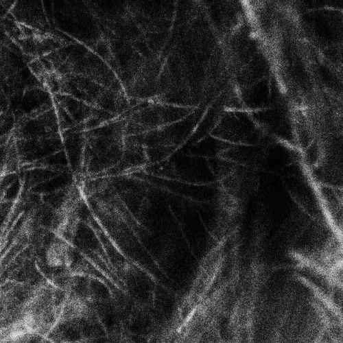 HADOPELAGYAL - Haematophoryktos DIGI